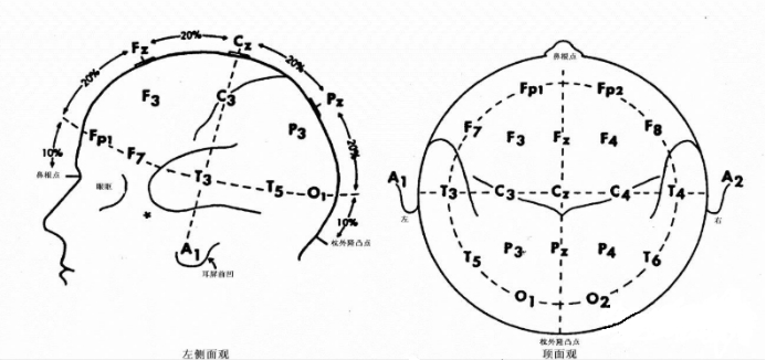 10-20system
